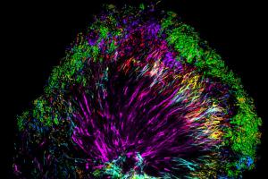 Фотографии зубов под микроскопом или как в действительности выглядит зубной налет Микробы во рту человека
